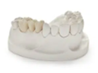 Maryland Bridges dental laboratory solution