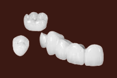 Composite Crowns dental laboratory solution