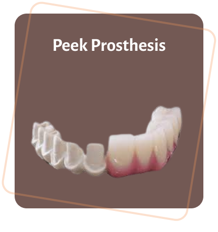 Specialized dental prosthesis model